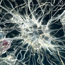 DNA damage & Neurons